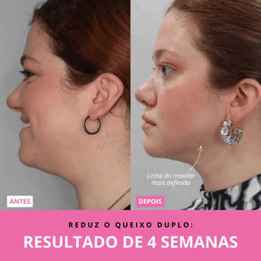 Aurea Glow™ | Rejuvenescedor Facial LED + Sérum GRÁTIS