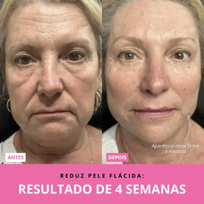 Aurea Glow™ | Rejuvenescedor Facial LED + Sérum GRÁTIS